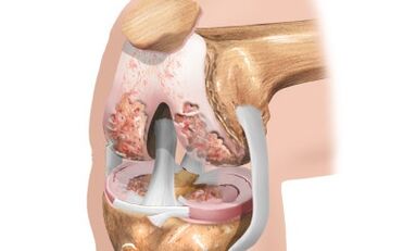 Shema ligamenata