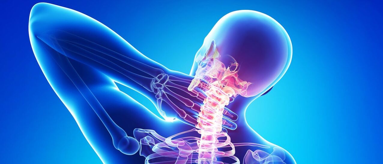 Osteohondroza grlića maternice patološki je proces u području kralježnice