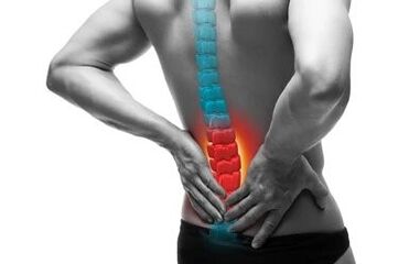 Osteokondroza je bolest kralježnice