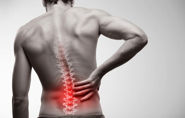 bol u donjem dijelu leđa zbog osteohondroze